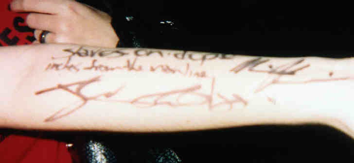Charity's signed arm